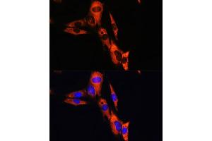 Immunofluorescence analysis of NIH/3T3 cells using B1 antibody (ABIN6127387, ABIN6137304, ABIN6137307 and ABIN6216023) at dilution of 1:100. (ATP1B1 抗体  (AA 65-240))