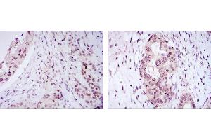 Immunohistochemistry (IHC) image for anti-Nucleus Accumbens Associated 1, BEN and BTB (POZ) Domain Containing (NACC1) antibody (ABIN969307)
