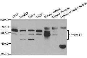 Western blot analysis of extracts of various cell lines, using PRPF31 antibody. (PRPF31 抗体)