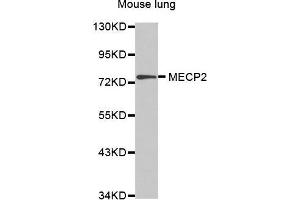 Western Blotting (WB) image for anti-Methyl CpG Binding Protein 2 (MECP2) (AA 1-280) antibody (ABIN5663752) (MECP2 抗体  (AA 1-280))