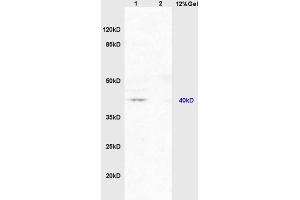 Lane 1: mouse brain lysates Lane 2: mouse embryo lysates probed with Anti PAR-2 Polyclonal Antibody, Unconjugated (ABIN738816) at 1:200 in 4 °C. (NR1I2 抗体  (AA 101-150))