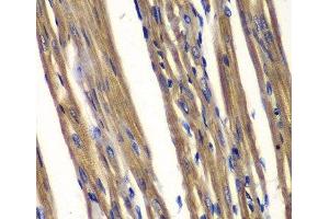 Immunohistochemistry of paraffin-embedded Rat heart using PTPN2 Polyclonal Antibody at dilution of 1:100 (40x lens). (PTPN2 抗体)