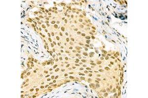 Immunohistochemistry (Paraffin-embedded Sections) (IHC (p)) image for anti-Poly A Binding Protein Nuclear 1 (PABPN1) antibody (ABIN7075116)