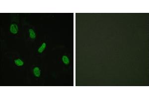 Peptide - +Immunohistochemistry analysis of paraffin-embedded human brain tissue using Androgen Receptor antibody. (Androgen Receptor 抗体  (Internal Region))
