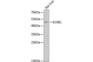 Western blot analysis of extracts of rat liver, using KLRB1 antibody (ABIN6130055, ABIN6142970, ABIN6142972 and ABIN6222669) at 1:3000 dilution. (CD161 抗体  (AA 73-140))