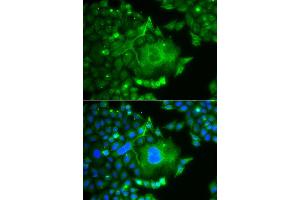 Immunofluorescence analysis of A549 cell using CACNG4 antibody. (CACNG4 抗体)