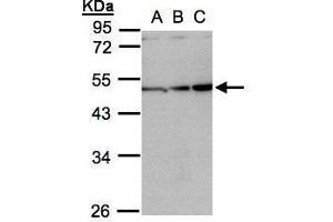 WB Image Sample(30 ug whole cell lysate) A:H1299 B:HeLa S3, C:Hep G2 , 10% SDS PAGE antibody diluted at 1:1000 (INHBA 抗体  (C-Term))