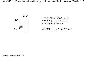 Image no. 2 for anti-Vesicle-Associated Membrane Protein 3 (VAMP3) (N-Term) antibody (ABIN347002) (VAMP3 抗体  (N-Term))