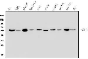 Western blot analysis of OXCT1/SCOT using anti-OXCT1/SCOT antibody (ABIN7601419).