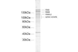 dilution: 1 : 100, sample: crude synaptic membranes fraction of rat brain (LP1) (RIMS2 抗体  (AA 461-987))