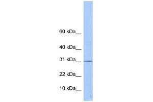 WB Suggested Anti-ECHDC1 Antibody Titration:  0. (ECHDC1 抗体  (Middle Region))