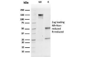 SDS-PAGE Analysis Purified CD31 Mouse Monoclonal Antibody (PECAM1/3527).