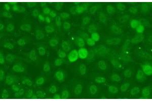 Immunofluorescence analysis of A549 cells using SSNA1 Polyclonal Antibody (SSNA1 抗体)