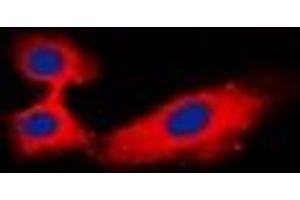 Immunofluorescent analysis of Rabphilin 3A staining in Hela cells. (RPH3A 抗体)
