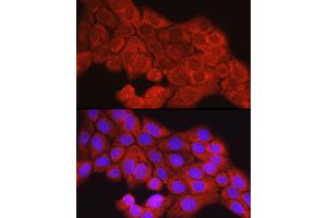 Immunofluorescence analysis of  cells using [KO Validated] SCD Rabbit pAb (ABIN7270589) at dilution of 1:150 (40x lens). (SCD 抗体  (C-Term))