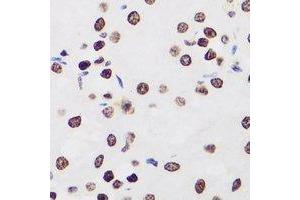 Immunohistochemical analysis of Ikaros staining in human kidney formalin fixed paraffin embedded tissue section. (IKZF1 抗体)