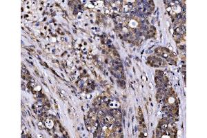 IHC analysis of EXOSC3 using anti-EXOSC3 antibody (ABIN7602216). (EXOSC3 抗体  (AA 64-275))