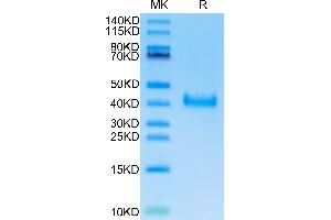 SDS-PAGE (SDS) image for SARS-CoV-2 Spike (BA.2.12.1 - Omicron), (RBD) protein (His tag) (ABIN7273900)