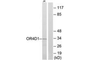 Western blot analysis of extracts from Jurkat cells, using OR4D1 Antibody.