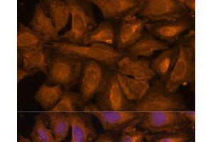 Immunofluorescence analysis of U-2 OS cells using STUB1 Polyclonal Antibody at dilution of 1:100 (40x lens). (STUB1 抗体)