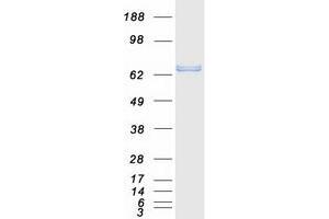 Western Blotting (WB) image for Epsin 2 (EPN2) (Transcript Variant 2) protein (Myc-DYKDDDDK Tag) (ABIN2720355)