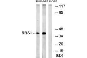 Western blot analysis of extracts from HuvEc/293 cells, using RRS1 Antibody.