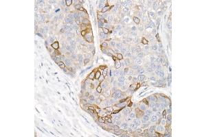 Immunohistochemistry (IHC) image for anti-Keratin 16 (KRT16) (AA 190-430) antibody (ABIN6143021)