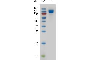 SDS-PAGE (SDS) image for Vascular Cell Adhesion Molecule 1 (VCAM1) (AA 25-698) protein (His tag) (ABIN7491073)