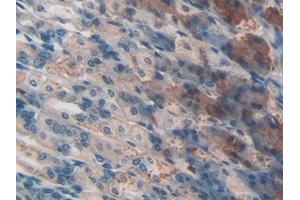 DAB staining on IHC-P; Samples: Mouse Stomach Tissue (CD46 抗体  (AA 157-365))