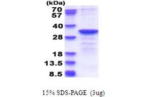 SDS-PAGE (SDS) image for Cytochrome B5 Reductase 2 (CYB5R2) (AA 1-276) protein (His tag) (ABIN5853701) (CYB5R2 Protein (AA 1-276) (His tag))