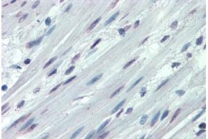 Anti-ITGA3 / CD49c antibody  ABIN960785 IHC staining of human colon, smooth muscle. (ITGA3 抗体  (N-Term))