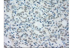 Immunohistochemical staining of paraffin-embedded pancreas tissue using anti-MAP2K4mouse monoclonal antibody. (MAP2K4 抗体)