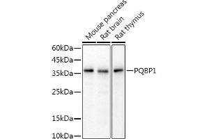 Western blot analysis of extracts of various cell lines, using PQBP1 antibody (ABIN7269452) at 1:1000 dilution. (PQBP1 抗体)