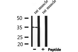 Western blot analysis of extracts from rat muscle, using TAS2R44 Antibody. (TAS2R31 抗体)