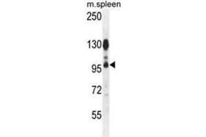 ACAP1 Antibody (N-term) western blot analysis in mouse spleen tissue lysates (35 µg/lane). (ACAP1 抗体  (N-Term))