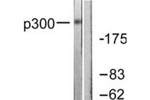 Western blot analysis of extracts from MDA-MB-435 cells, using p300 Antibody. (p300 抗体  (AA 1-50))