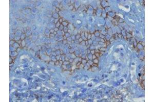 Immunohistochemistry (IHC) image for anti-Complement Fragment 3d (C3d) (N-Term) antibody (ABIN870581) (Complement C3d 抗体  (N-Term))