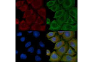 ABIN6259001 and ABIN6276114 staining Hela cells(45 min of heat-shock) by IF/ICC.