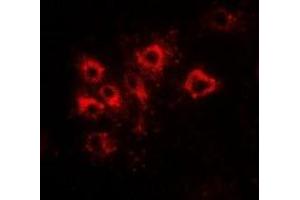 Immunofluorescent analysis of Tapasin staining in Hela cells. (TAPBP 抗体)