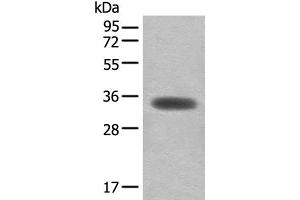 Western blot analysis of Mouse skeletal muscle tissue lysate using MYOZ2 Polyclonal Antibody at dilution of 1:450 (MYOZ2 抗体)
