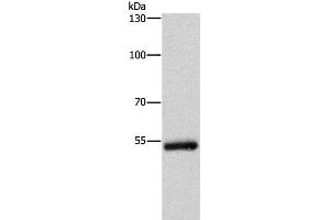 Western Blot analysis of Human colon cancer tissue using CYP2B6 Polyclonal Antibody at dilution of 1:400 (CYP2B6 抗体)