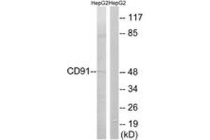 Western blot analysis of extracts from HepG2 cells, using CD91 (Ab-4520) Antibody. (LRP1 抗体  (AA 4486-4535))