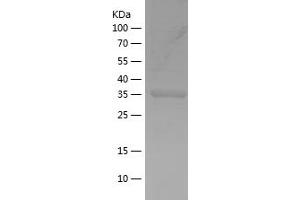 FYN Protein (AA 41-190) (His-IF2DI Tag)