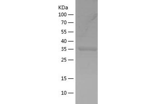 FYN Protein (AA 41-190) (His-IF2DI Tag)