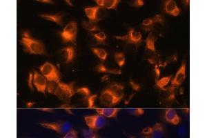 Immunofluorescence analysis of C6 cells using SSTR2 Polyclonal Antibody at dilution of 1:100 (40x lens). (SSTR2 抗体)