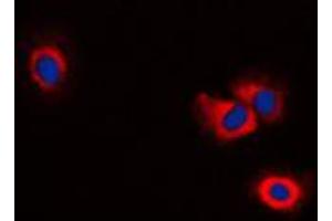 Immunofluorescent analysis of ERAP1 staining in NIH3T3 cells. (ERAP1 抗体  (Center))