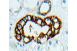 Used in DAB staining on fromalin fixed paraffin-embedded Kidney tissue (FKBP8 抗体  (AA 93-339))