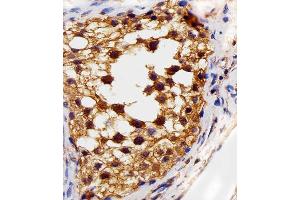 Immunohistochemical analysis of paraffin-embedded H. (FLT4 抗体  (AA 1-439))