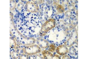 Immunohistochemistry of paraffin-embedded Rat kidney using DCTD Polyclonal Antibody at dilution of 1:200 (40x lens). (DCMP Deaminase (DCTD) 抗体)