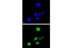 Confocal immunofluorescent analysis of p21 antibody with HepG2 cells followed by Alexa Fluor 488-conjugated goat anti-rabbit lgG (green). (p21 抗体  (AA 105-140))